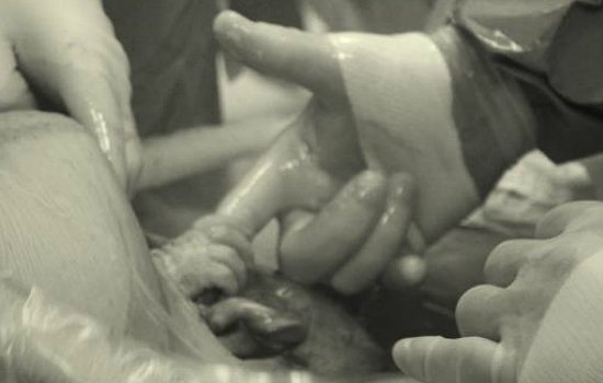 Születése közben fogta meg az orvos ujját a baba - fotó