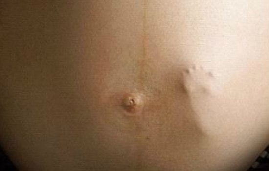 Születése közben fogta meg az orvos ujját a baba - fotó